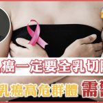 《醫+ So Healthy》報導：乳癌就一定要手術全乳切除？8 類乳癌高危群體需警惕！