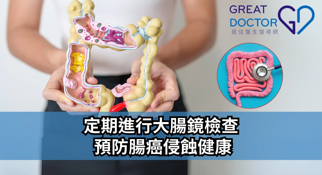 《Greatdoctor》報導：定期進行大腸鏡檢查 預防腸癌侵蝕健康